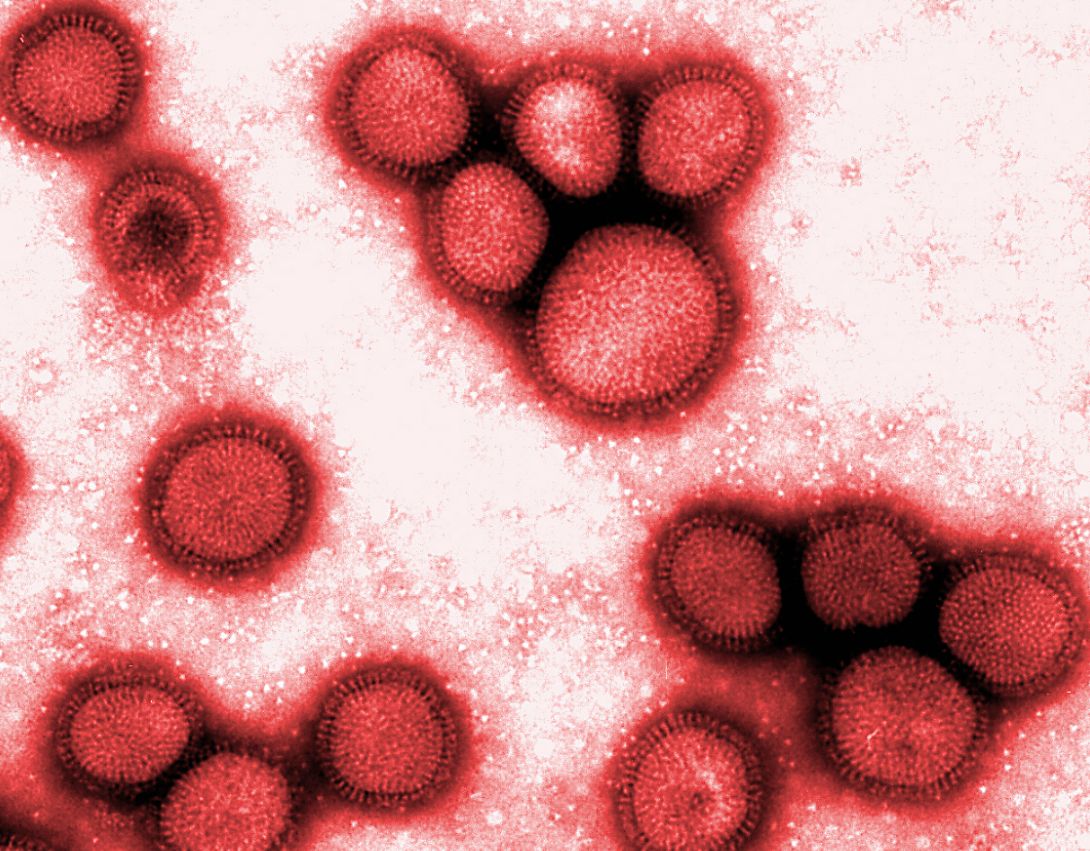 Influenza: Zwei Todesfälle in der Region