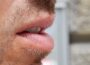 Ist Kamagra Oral Jelly eine wirksame Behandlung für erektile Dysfunktion?